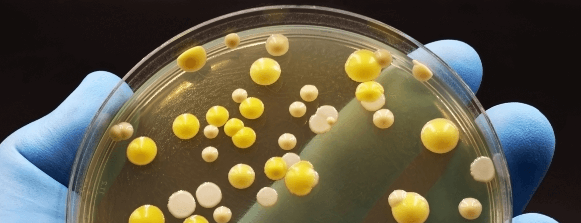 It’s the Rise of Superbugs…